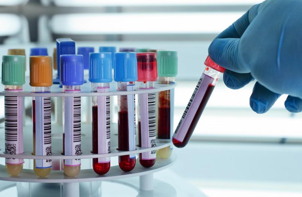 A medical professional drawing blood from a patient's arm using a syringe, with lab equipment in the background.