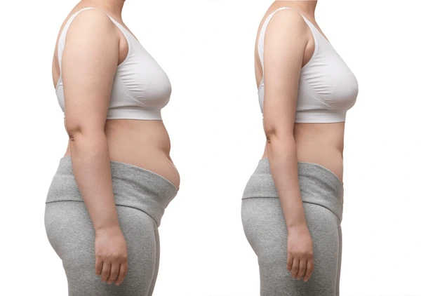 A woman jogging in the park, representing weight loss and a healthy lifestyle.