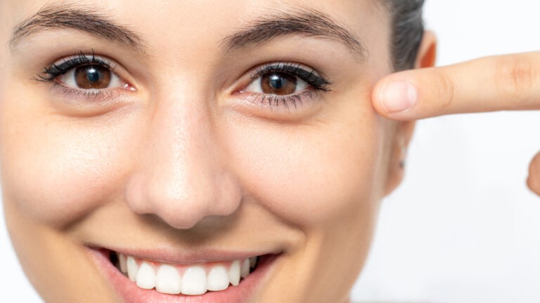 Botox for Crow’s Feet: How Many Units Do You Need?