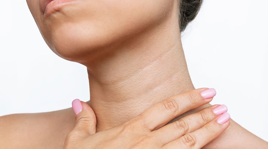 How to Prevent Neck Wrinkles: 6 Ways to Achieve Smooth Skin 