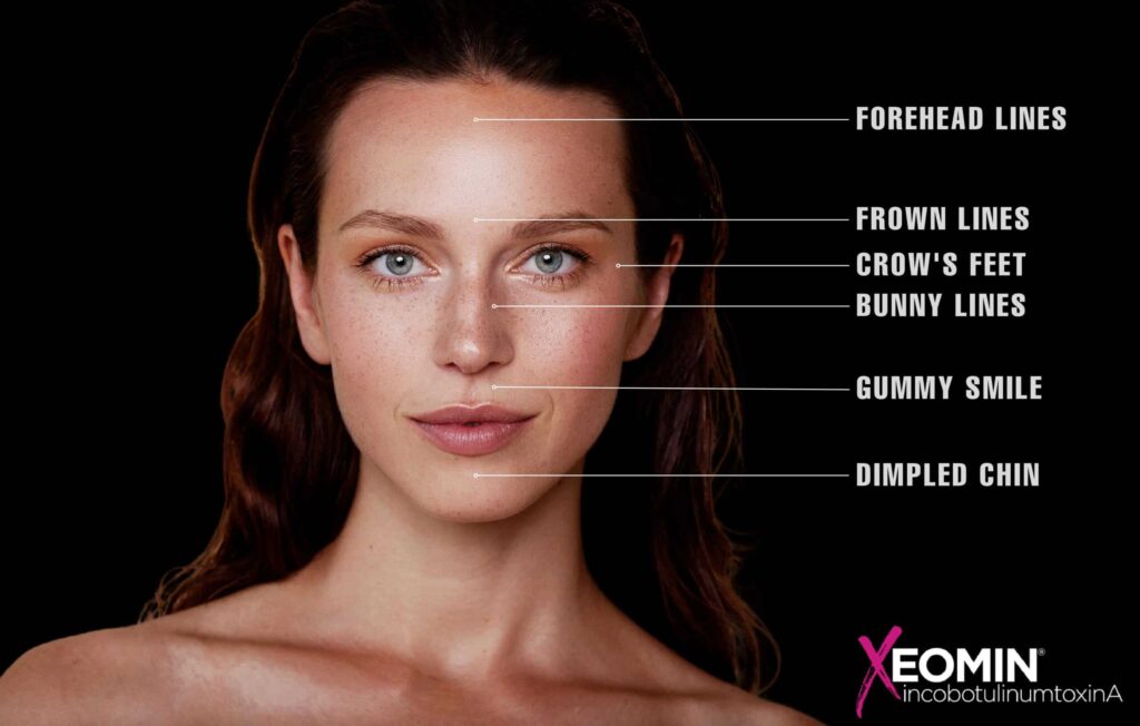 Revitalize Your Skin with Xeomin