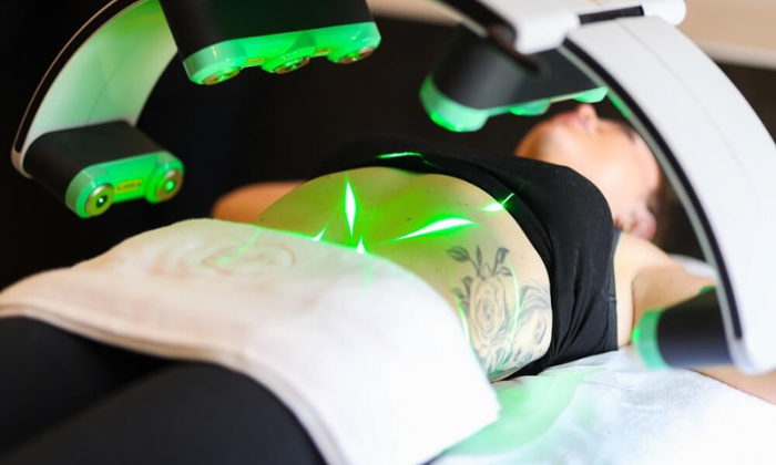 What You Need to Know About Your Laser Lipo Sessions at PÚR MedSpa