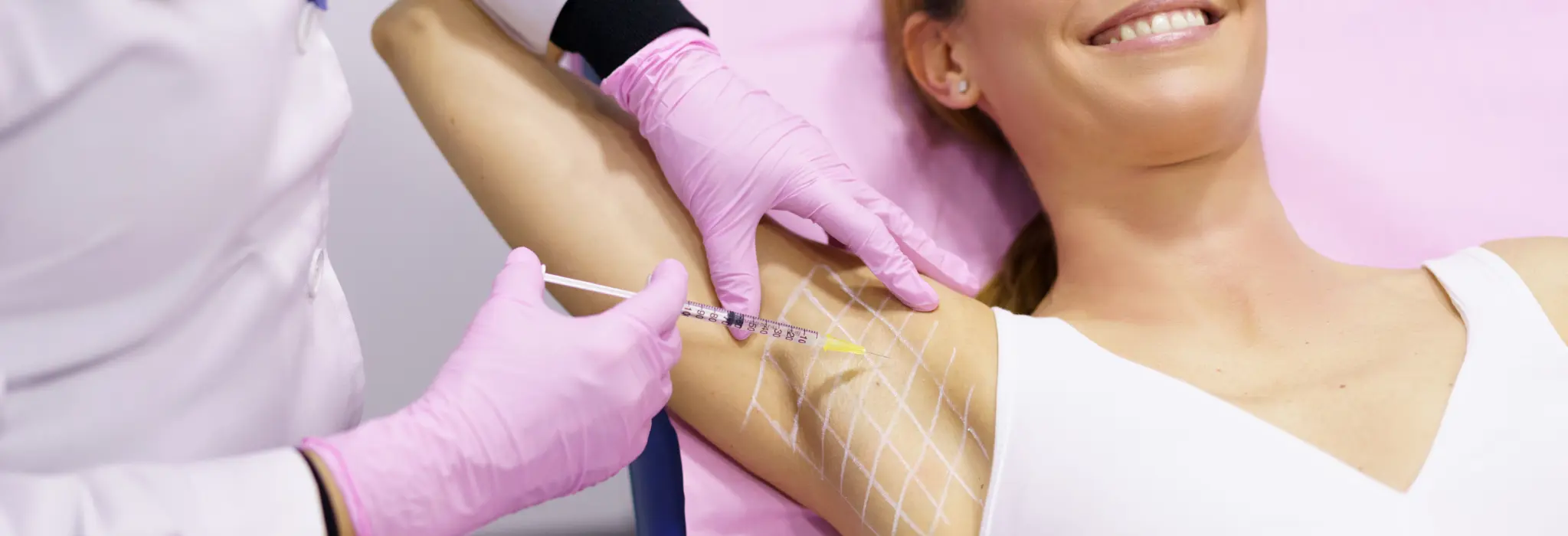 A close-up of a medical professional administering Botox injections into a patient's underarm to reduce excessive sweating, with medical tools in view.