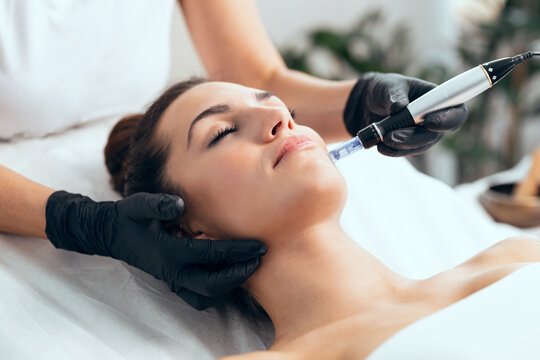 "Close-up of a dermatologist performing microneedling on a patient's face using a dermapen device in a clinical setting."