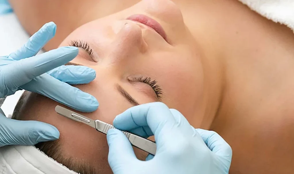 Close-up of a dermaplaning procedure showing a professional using a sterile blade to exfoliate the skin on a woman's face.