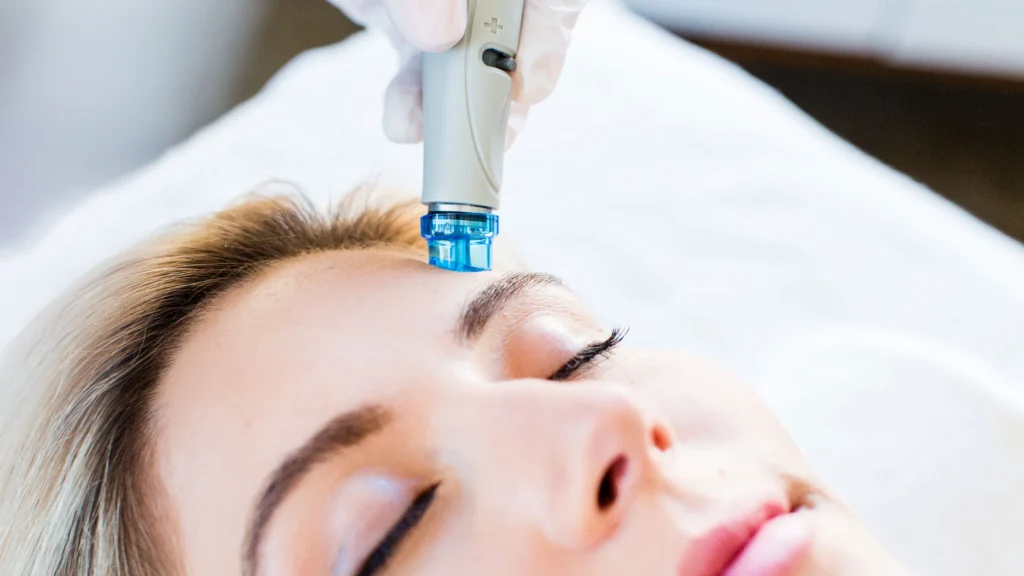 A close-up of a woman receiving a Hydrafacial treatment, showcasing glowing, refreshed skin during the session at PÚR MedSpa.